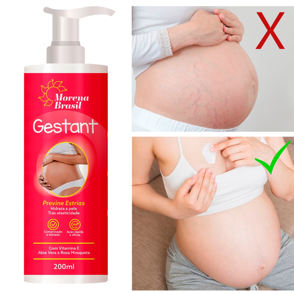 Creme para Estrias na Gestação: Onde Comprar | BuscaProdutos