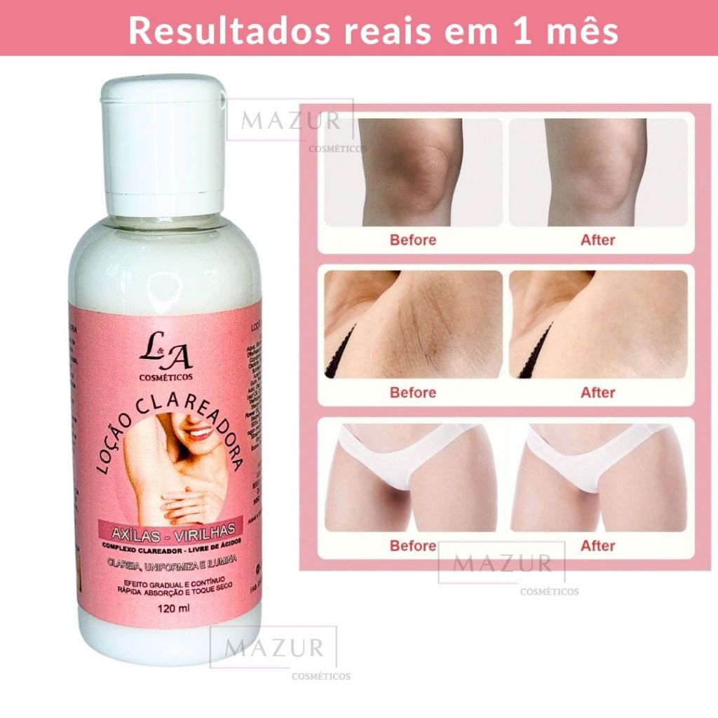 Creme Clareador de Axilas Virilha Joelhos Cotovelos Clareamento de Manchas Escuras Uniformiza