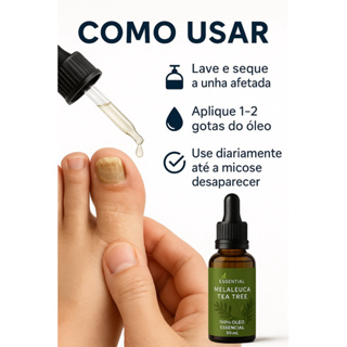 1 melauca  para micose nas unhas e fungos 30ml (the) verde em Oferta na Shopee
