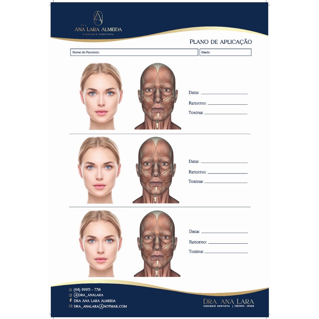 PLANO DE APLICAÇÃO BOTOX ACIDO HIALURONICO PRECEDIMENTO FACIAL