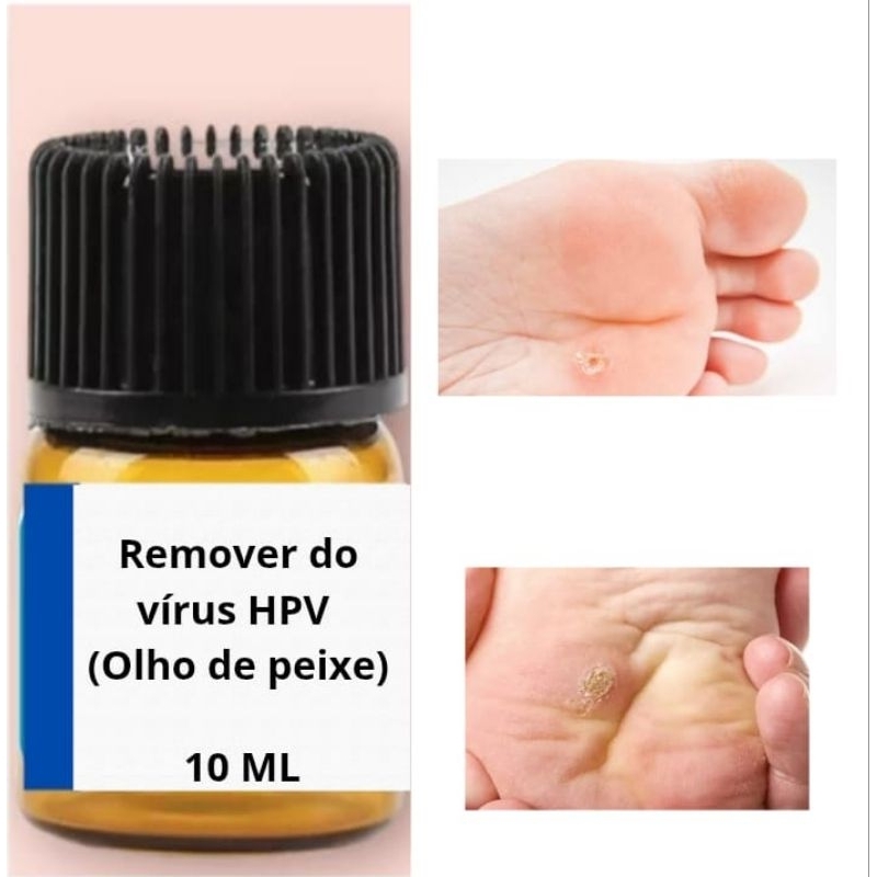 removedor de olho de peixe pés 10ml