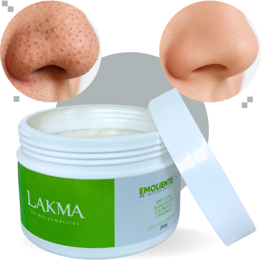 Creme Emoliente Lakma ZERO 250g Sem Trietanolamina 0% - Emoliência de Cravos e Espinhas Amolece