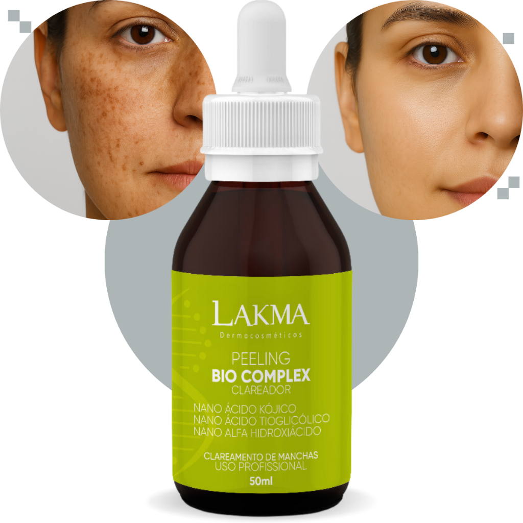 Peeling Bio Complex 50ml Clareador de Manchas e Melasma Facial Nano Ácidos Lakma