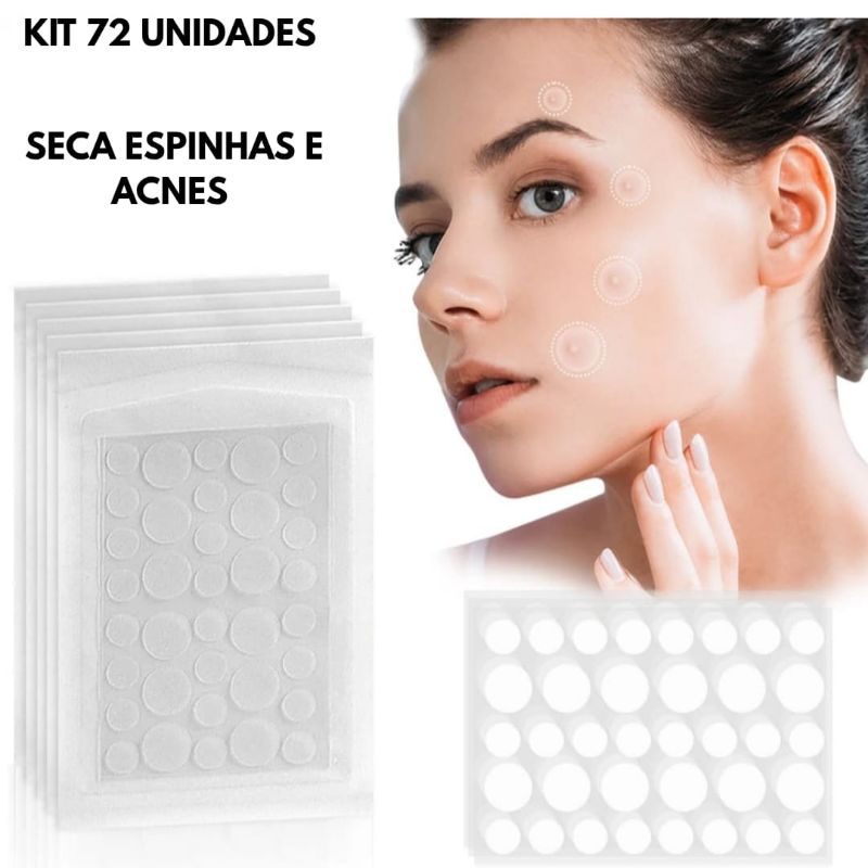 Kit 72 Adesivos Seca Espinha e Acnes Hidrocoloide em Oferta na Shopee