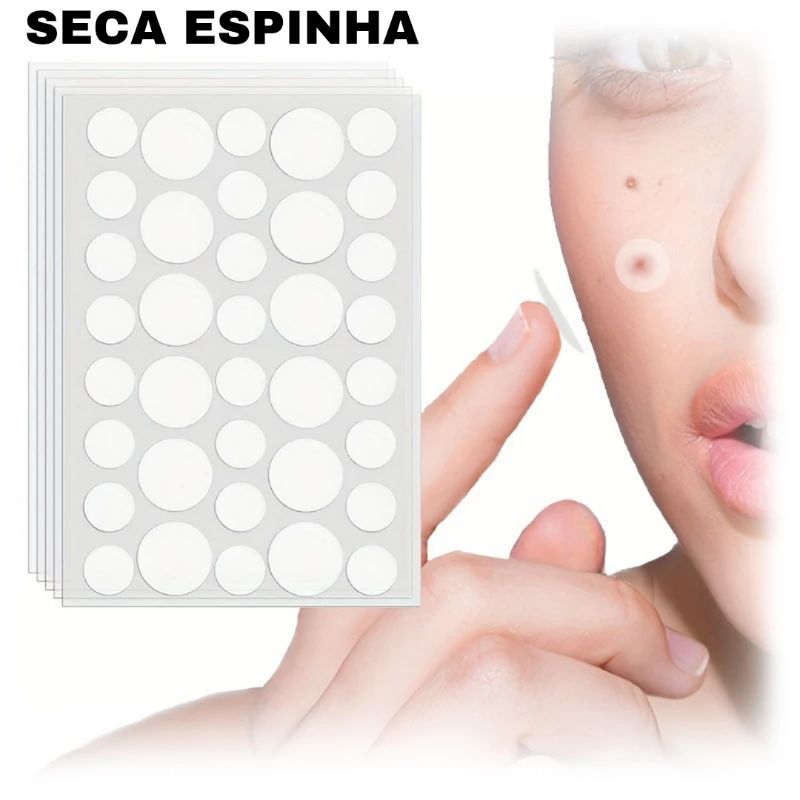 Kit 36 Adesivos Secativos Para Espinhas e Acnes Hidrocoloide