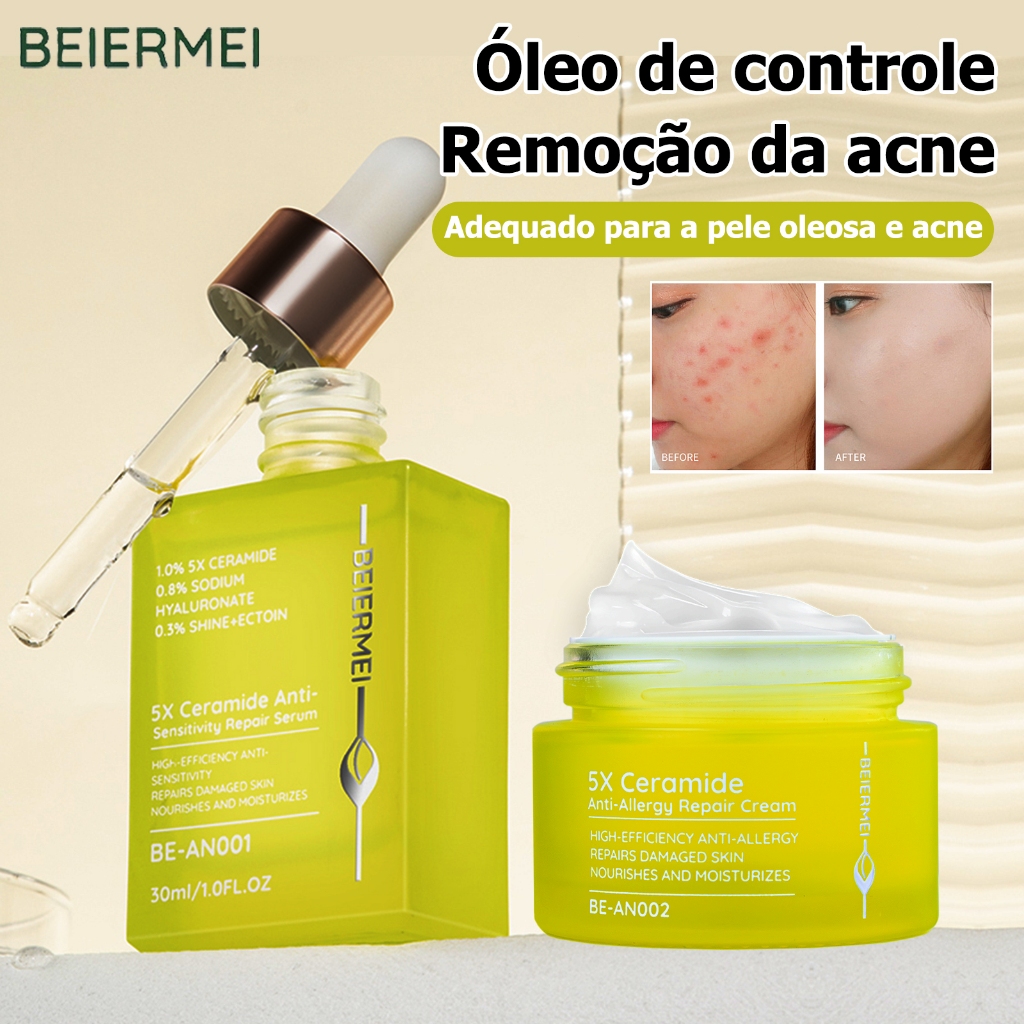 BEIERMEI Soro de remoção de acne de controle de óleo Reparar barreiras da pele e reduzir as marcas de acne em Oferta na Shopee