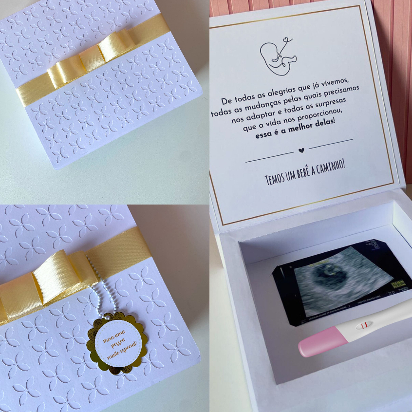 Caixa Surpresa Gravidez Avós: Onde Comprar | BuscaProdutos