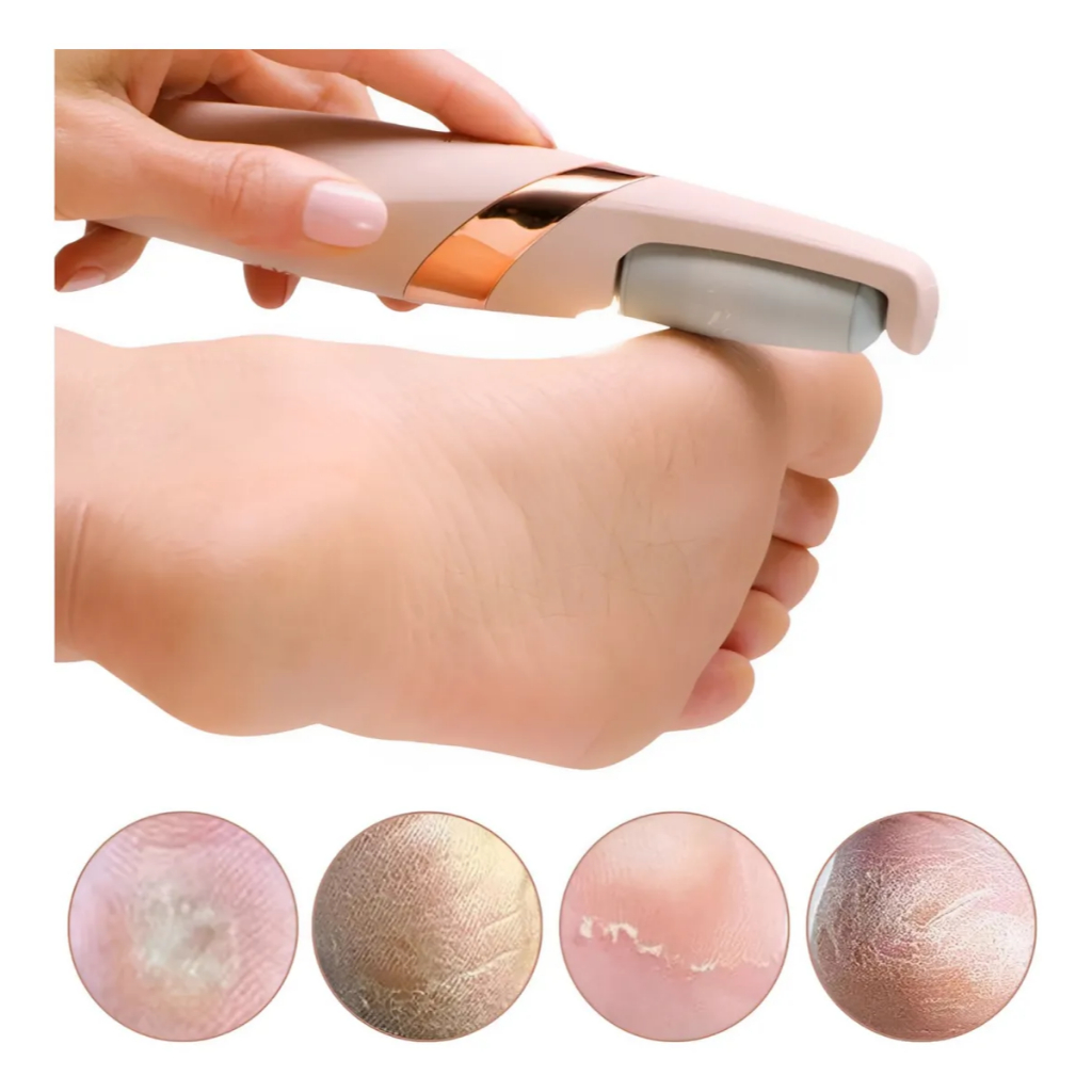 Aparelho de Lixar: Onde Comprar | BuscaProdutos