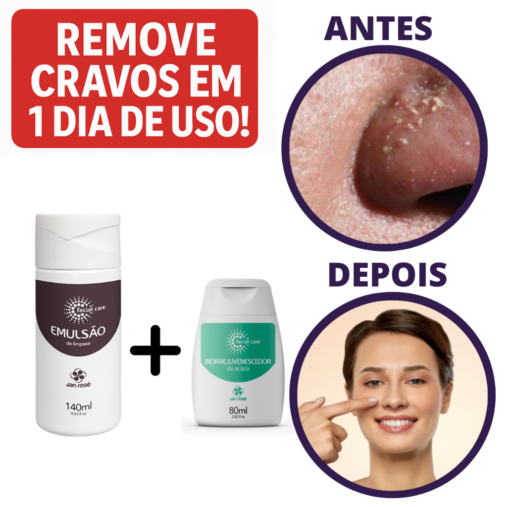 kit Skin Care Removedor de Cravos Cuidado Facial Espinha Máscara Removedora Limpeza Profunda Rosto