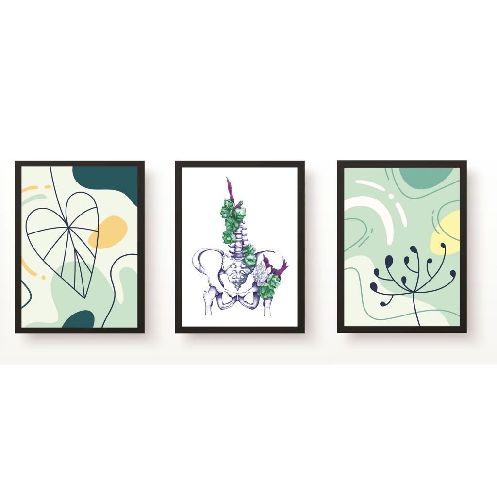 Kit 3 Quadros Decorativos Pelve Ginecologia Medicina Molduras 20x30cm Madeira Vidro Pretas