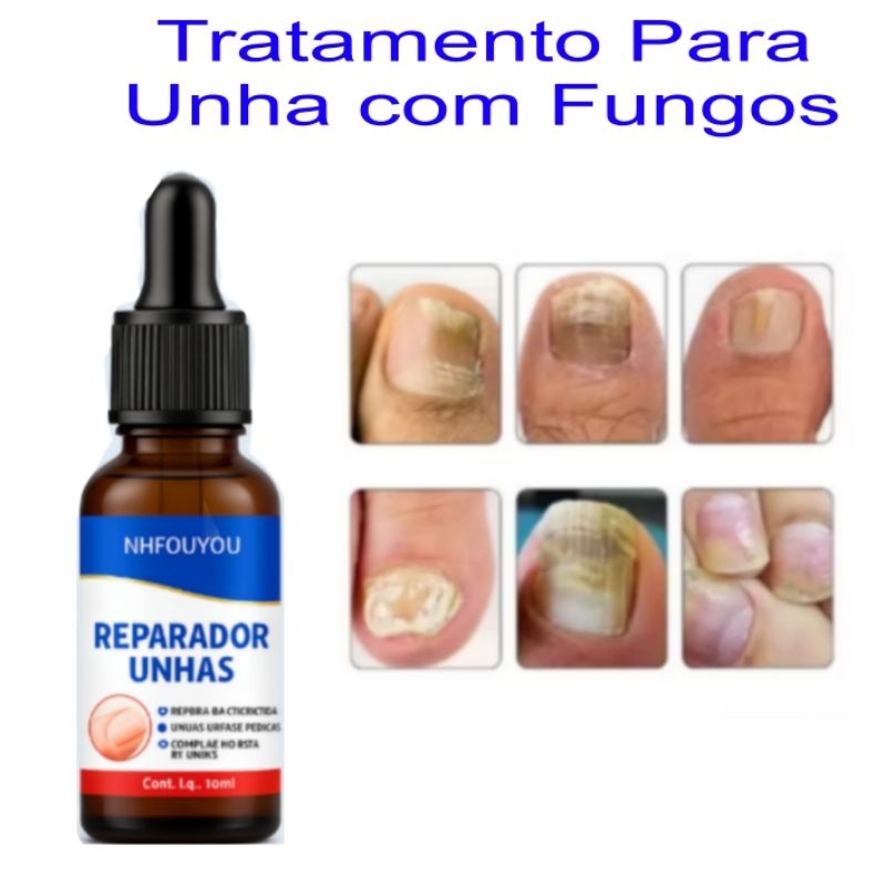 óleo para unhas 20ml em Oferta na Shopee