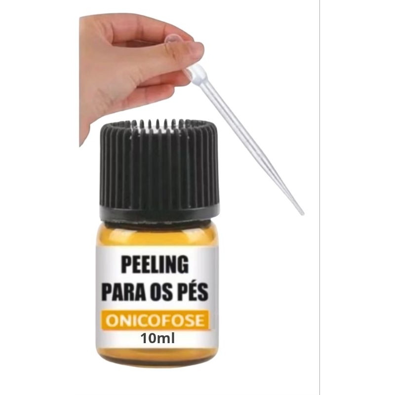 Peeling para os pés facilita a retirada de onicofose.