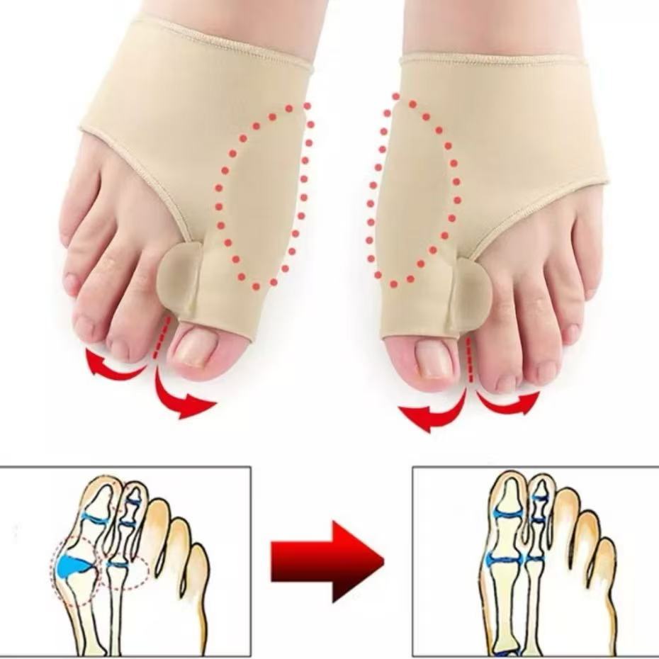 Par Meia Protetora Protetor Joanete Corretivo Ortopédico Alivia Dor Diurno e Noturno Reforçado-envio imediato em Oferta na Shopee