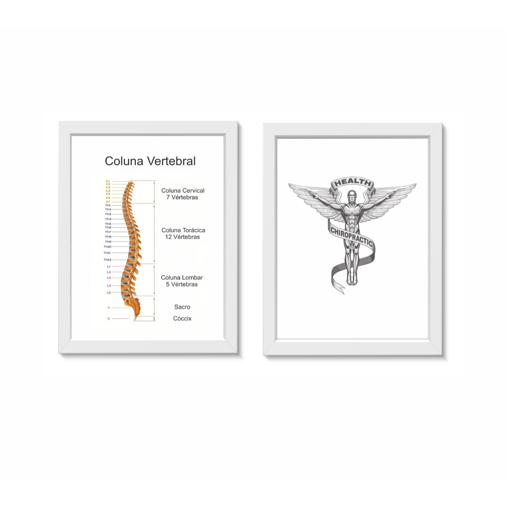 Kit 2 Quadros Decorativos Coluna Vertebral Ortopedia Quiropraxia Medicina Consultório  Moldura 20x30cm Madeira