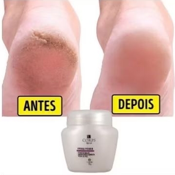 Hidra Power Creme Para Pés Rachados 55g Original Hinode – Hidratação Intensa Anti Ressecamento