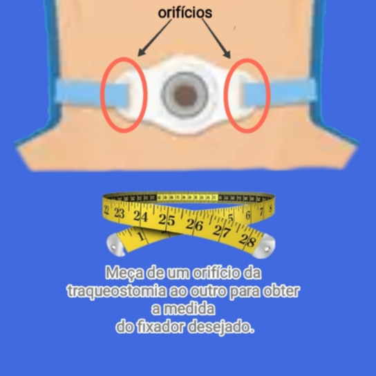 kit 2 unidades Fixador/Fita Para Traqueostomia/Adulto/Lavável.