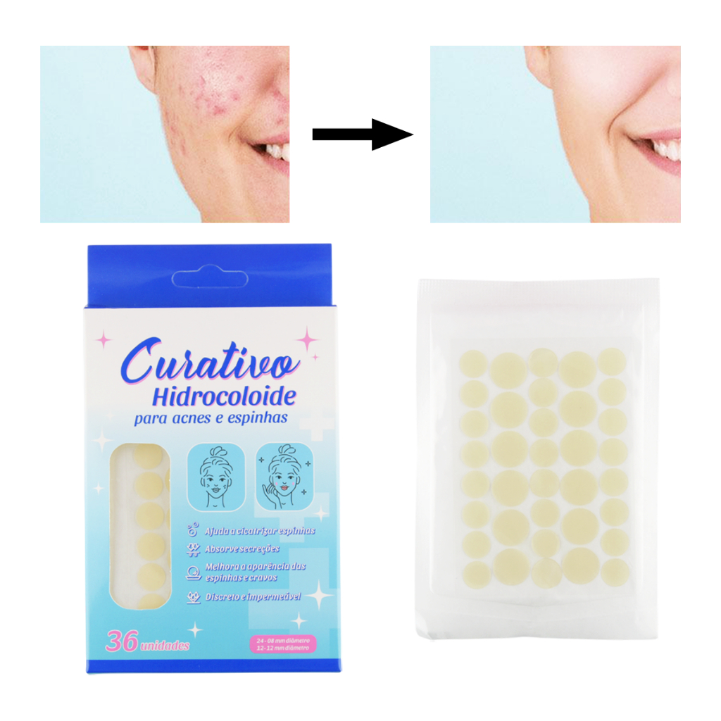 Adesivo para Cravos: Onde Comprar | BuscaProdutos