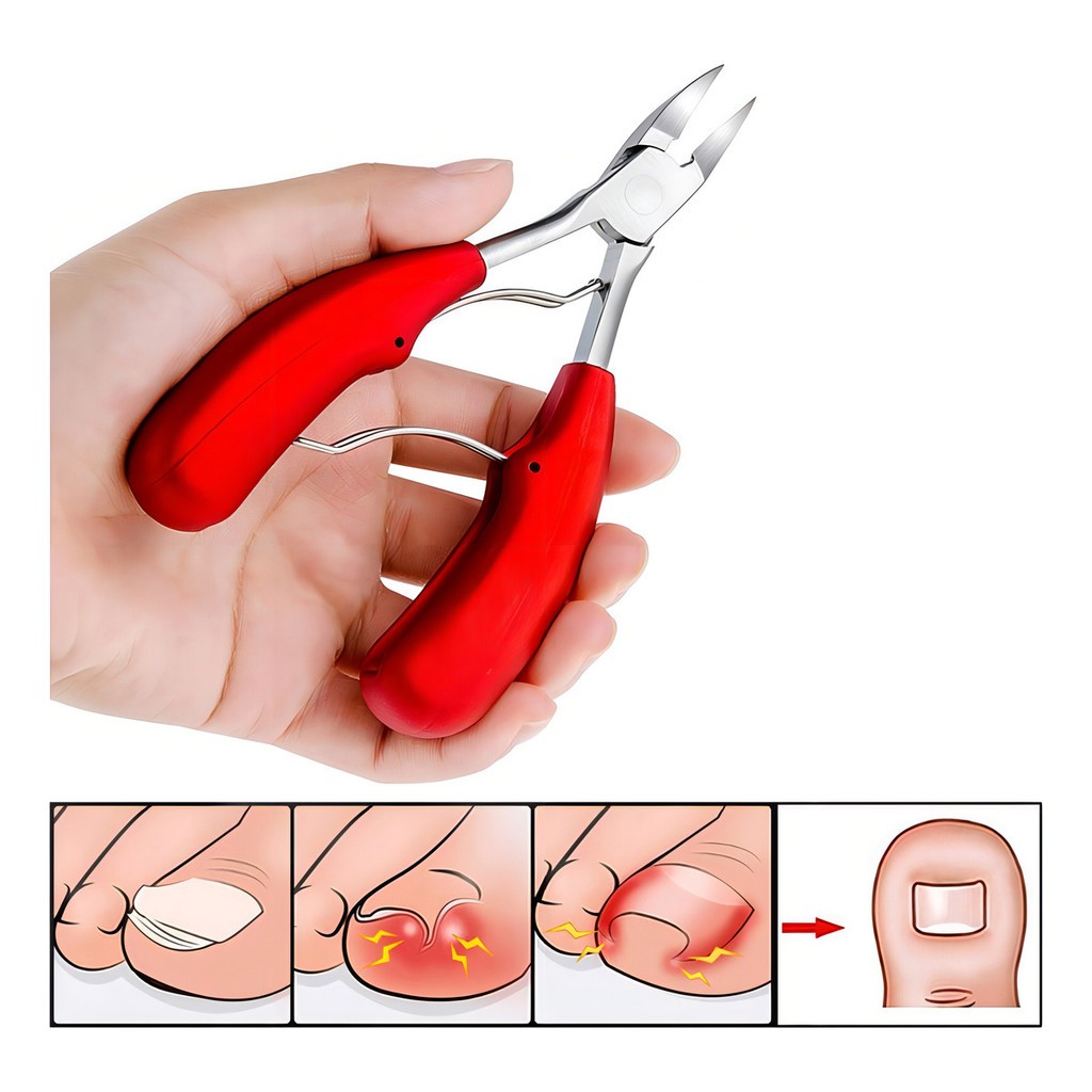 Alicate Profissional Para Desencravar E Cortar Unhas Grandes Encravadas mola dupla