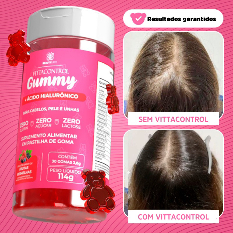 Vitamina Capilar Gummy + Ácido Hialurônico Vittacontrol ZERO SUPER CONCENTRADO