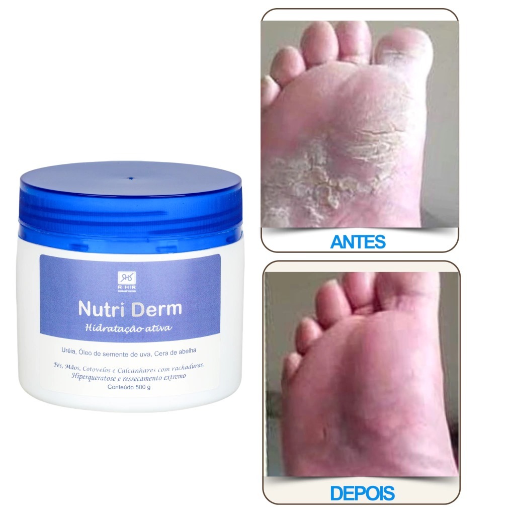 Creme Hidratante com Ureia - Nutri Derm 500gr — imagem 2 de 2