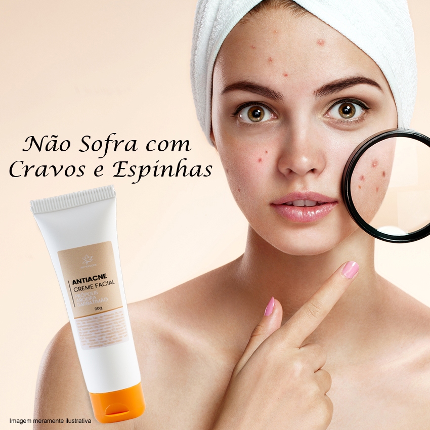 Creme Secativo para Espinha: Onde Comprar | BuscaProdutos