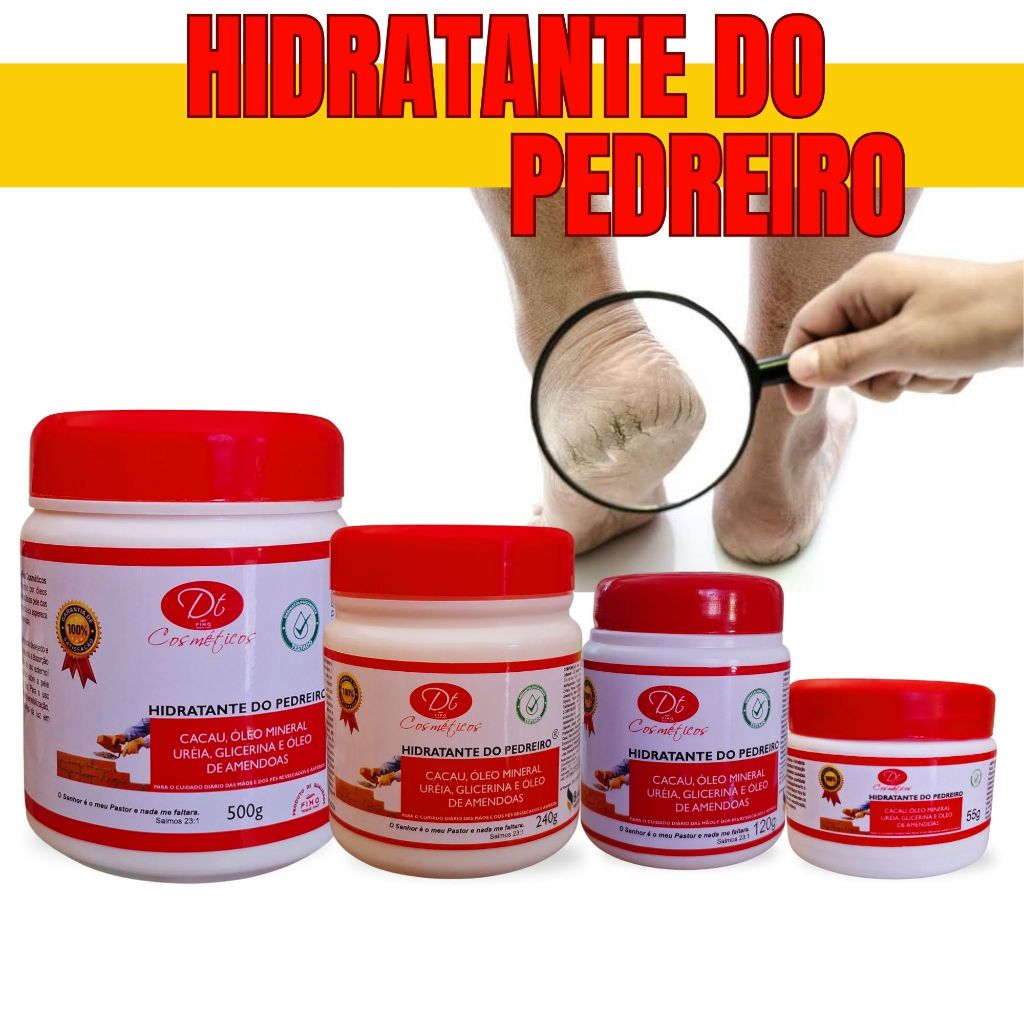Hidratante do Pedreiro Fixa 55g,120g,240g,500g Mãos,Pés,Joelhos Cotovelos Ressecados Rachados Creme