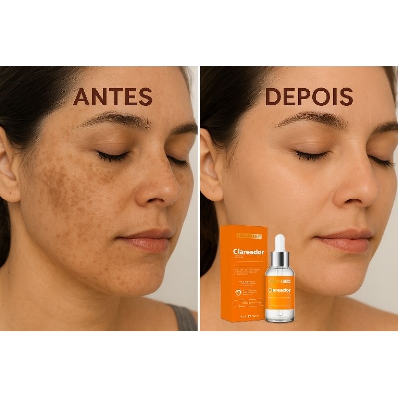 Sérum Clareador Clear Dermachem – Combate Melasma e Manchas, Deixa a Pele Mais Clara e Uniforme