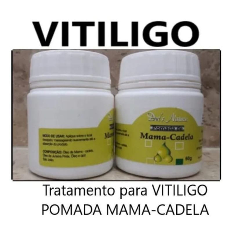 3 Pomadas Mama- Cadela (vitiligo) 60g Cada