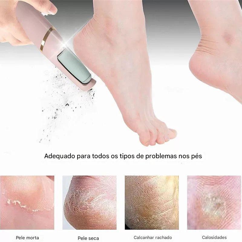 Lixador de Pé Elétrico - Esfoliador Tira Calos e Rachaduras Pedicure Portátil