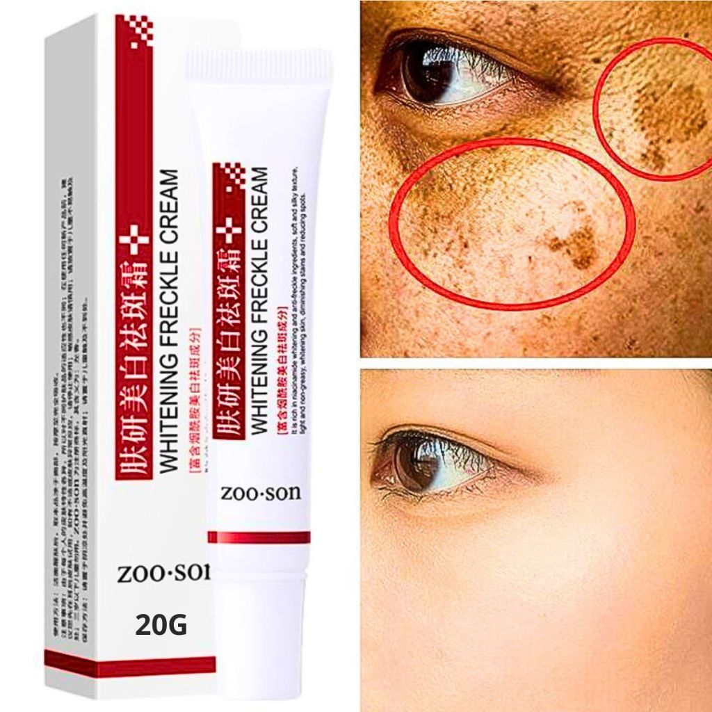 Creme Rosto Anti Manchas: Onde Comprar | BuscaProdutos