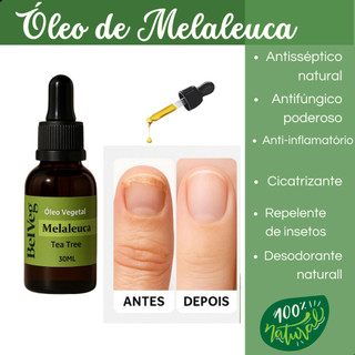 Óleo de Melaleuca Tea Tree 100% Puro 30ml  Para Unha Pele Cabelo..