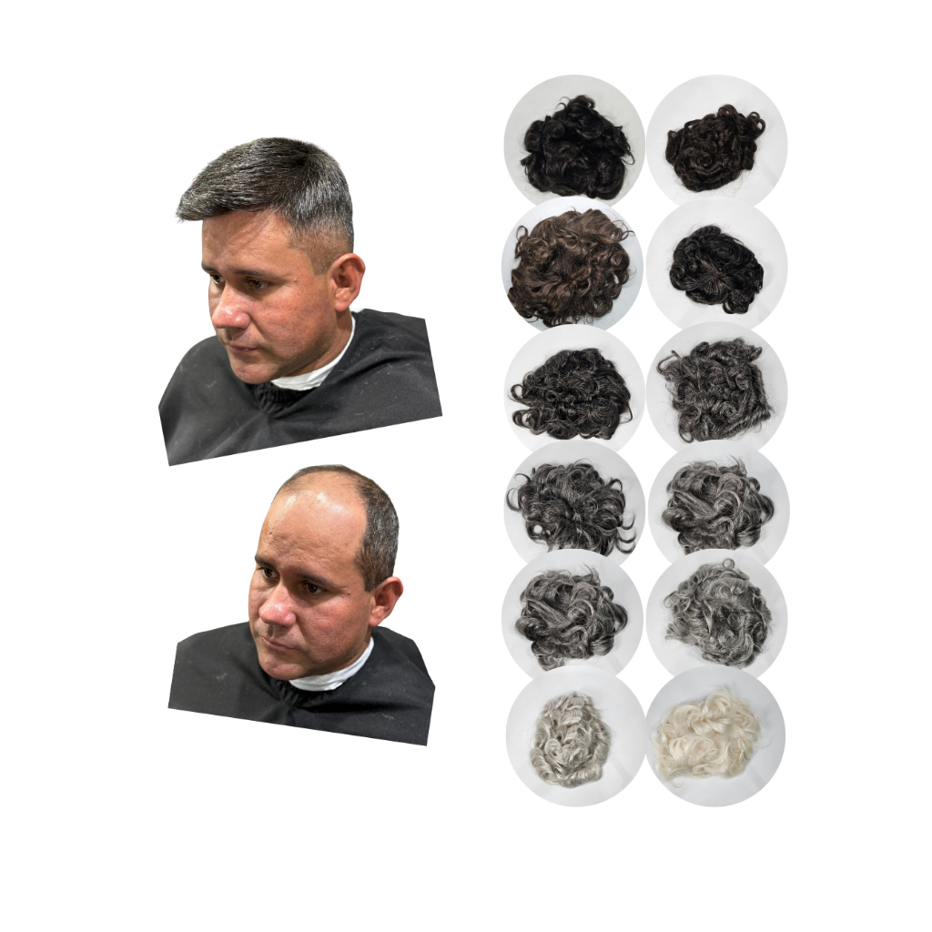 Prótese Capilar Micropele Masculina - Comprar com Melhor Preço em Anéis