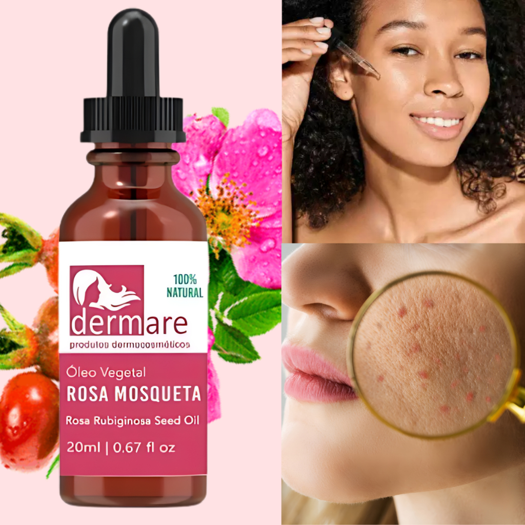 Óleo Vegetal de Rosa Mosqueta Dermare 100% Puro Extra Virgem Hidratação Regeneração Proteção da Pele