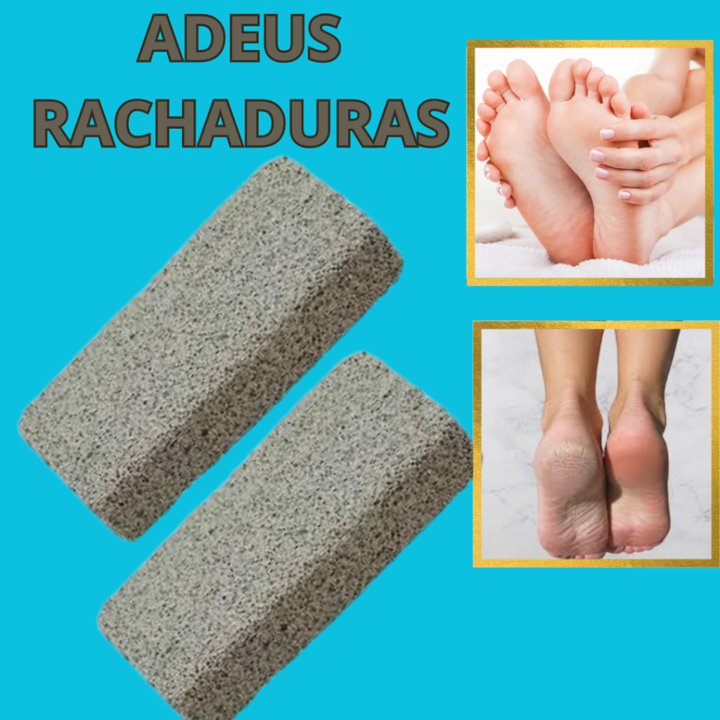 Promoção 2 Pedra Pomes  Esfoliação Lixa de pé Rachadura pedicure