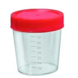 Frasco Coletor Universal Urina 80 Ml Estéril Pacote Com 100 unds