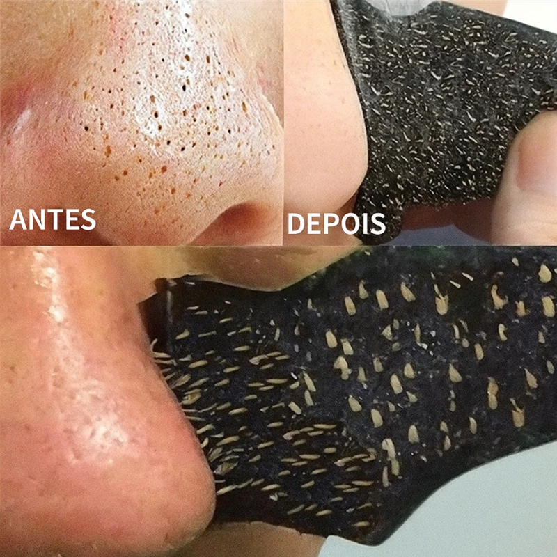 Adesivo para remover cravos no nariz com 5/10/30/50 unidades/Fita para remoção de cravo no nariz — imagem 1
