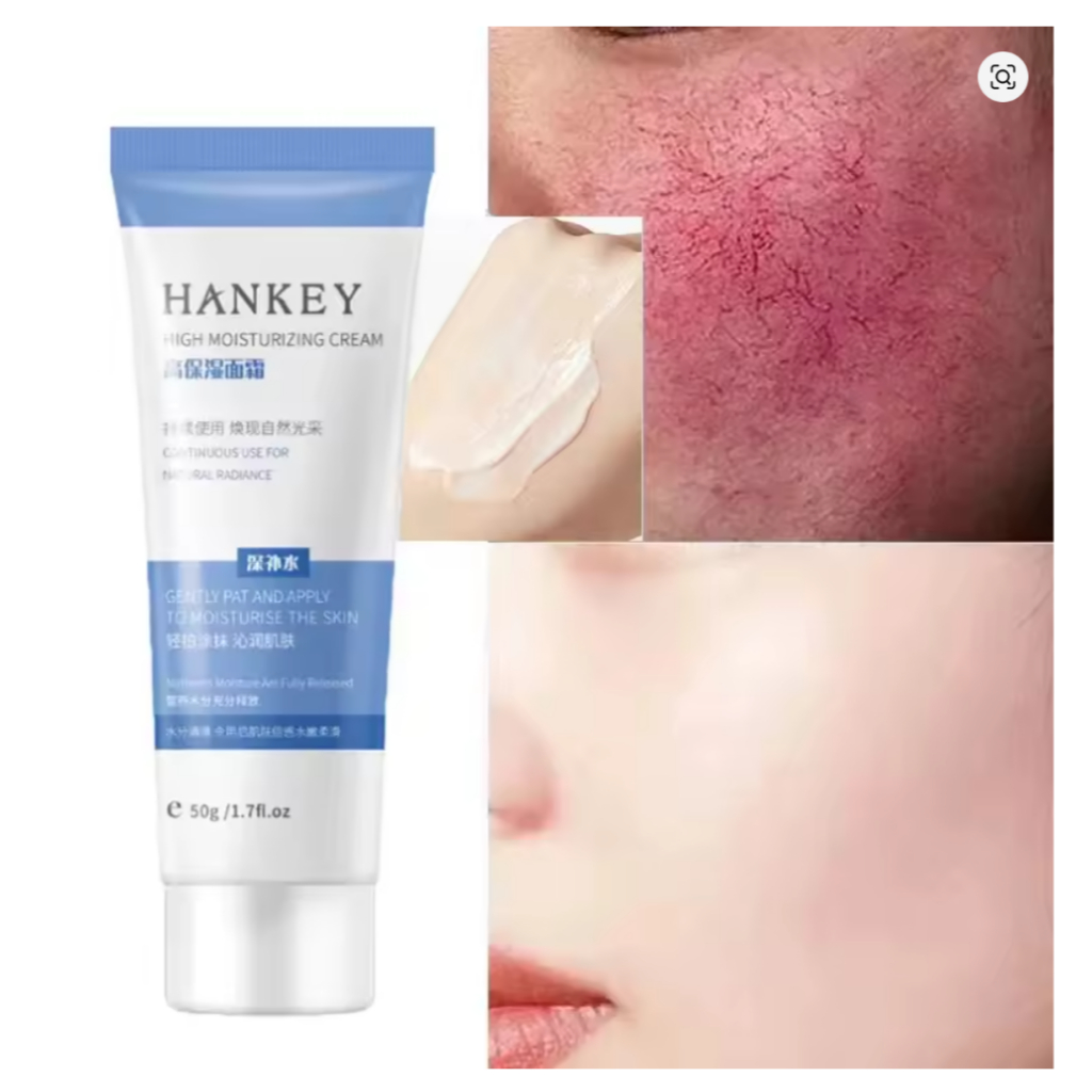 CREME FACIAL HANKEY PARA ROSACEA CLAREAMENTO VERMELHIDÃO E RESSECAMENTO em Oferta na Shopee