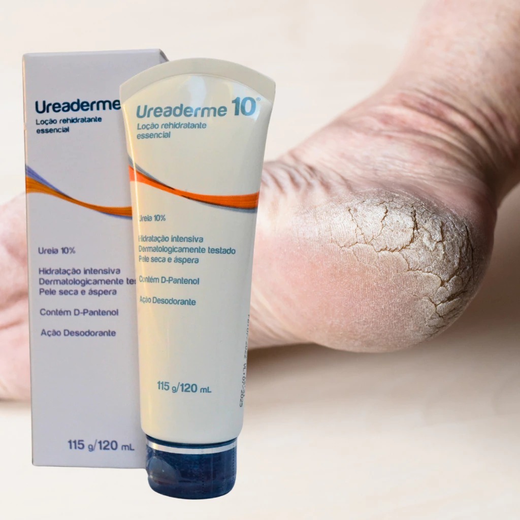Loção Ureaderme 10% Ureia 120ml Creme Hidratante + Cheiroso D-Pantenol - Nutriex