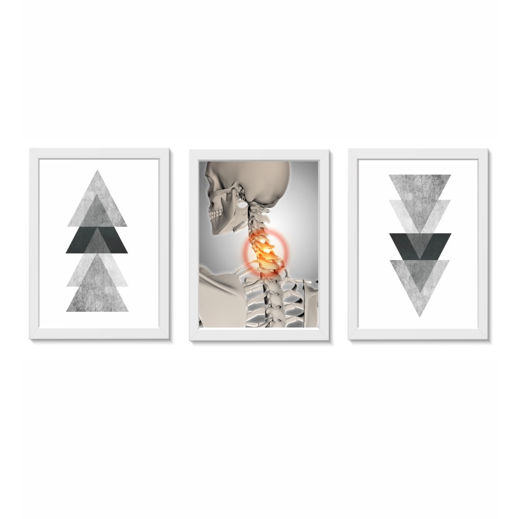Kit 3 Quadros Decorativos Pescoço Decoração Consultório Médico Ortopedia Fisioterapia Moldura 20x30cm Madeira