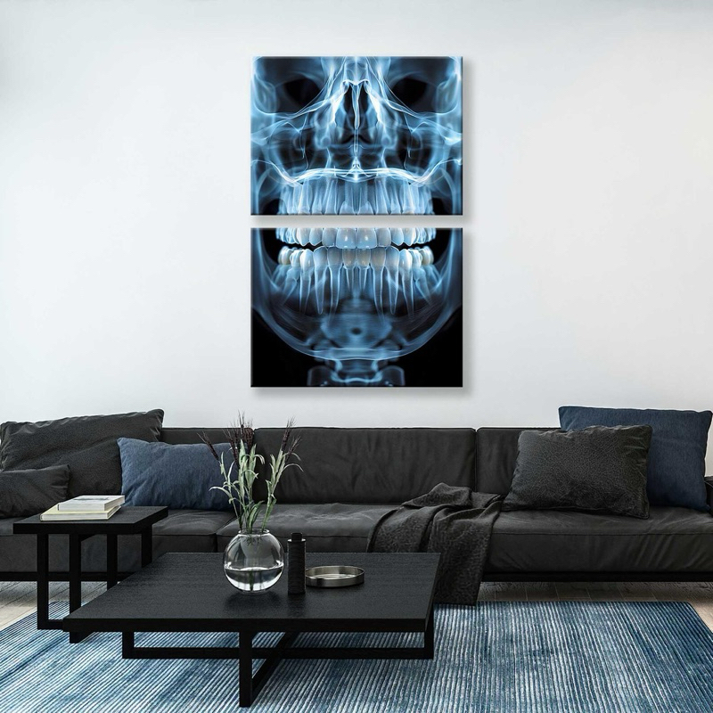Kit 2 Quadros Decorativos Crânio em Raio-X Moderno e Impactante Consultório Médico e Odontológico