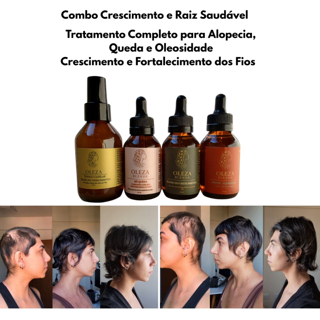 Terapia Capilar Kit 3 Blends Oleza + Tônico Capilar – Tratamento Completo para Alopecia, Queda e Oleosidade