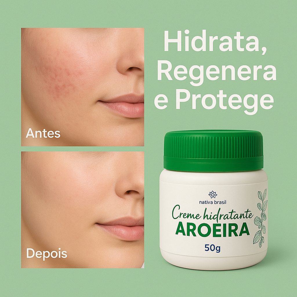 Creme de Aroeira 50g Antiacne Natural Auxilia cicatrização de Espinhas,  Foliculite e Hidrata a Pele
