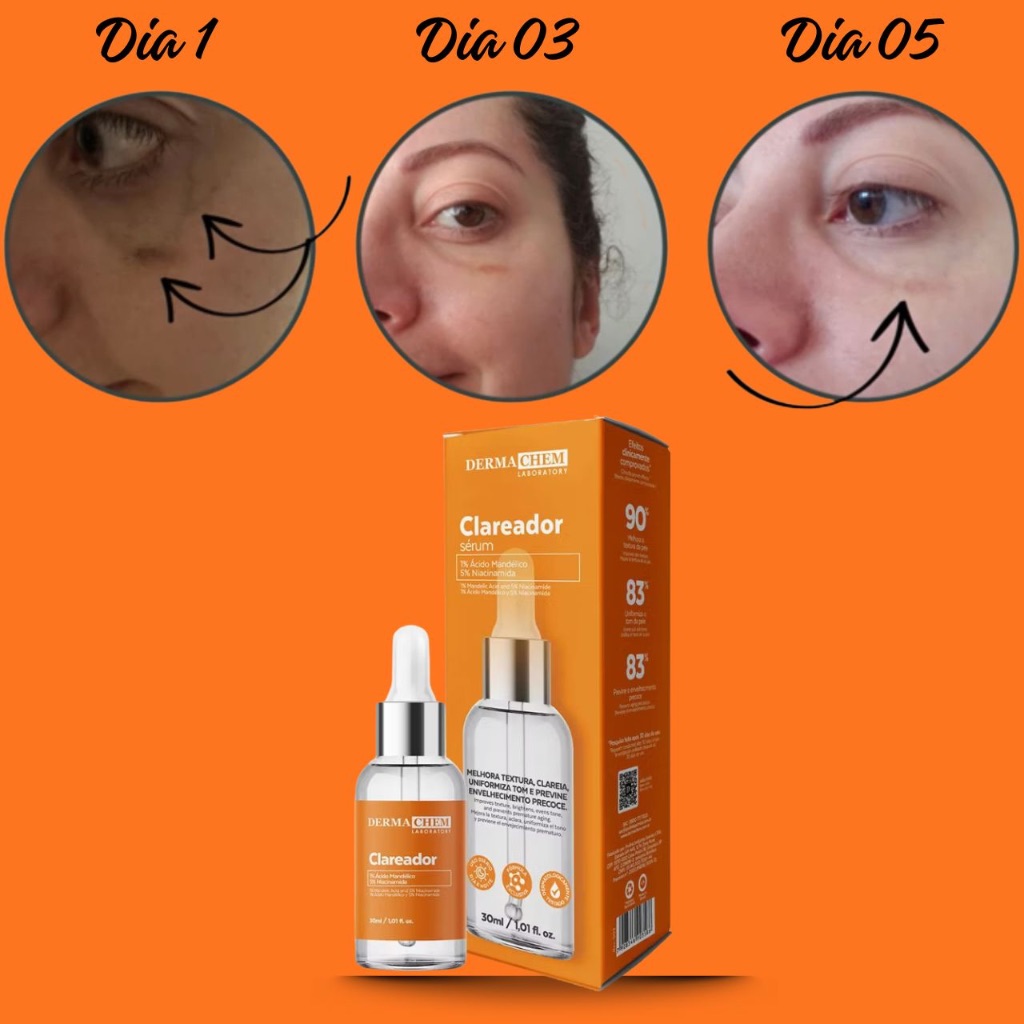 Sérum Clareador de Melasma Dermachem  Clareia Manchas -30ml