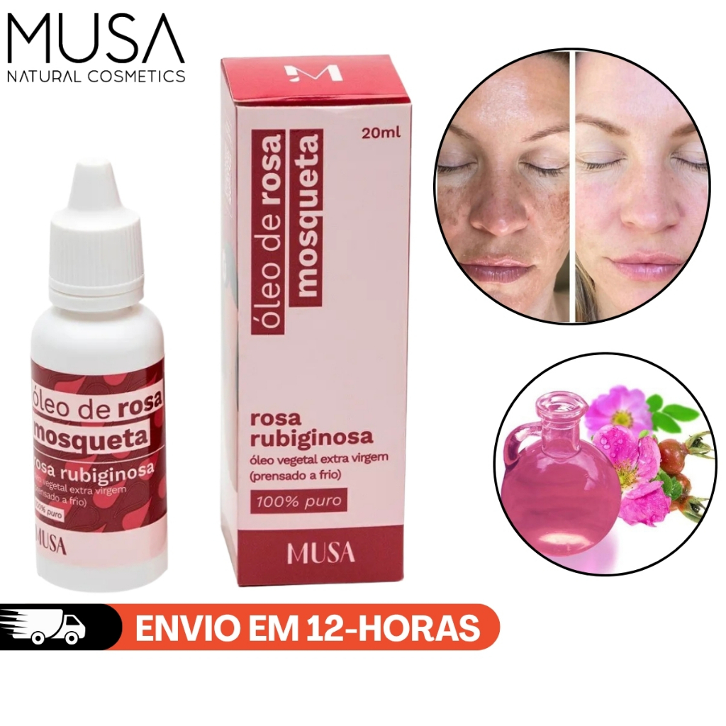 ÓLEO ROSA MOSQUETA RUBIGINOSA 100% PURO REGENERADOR 20ML MUSA