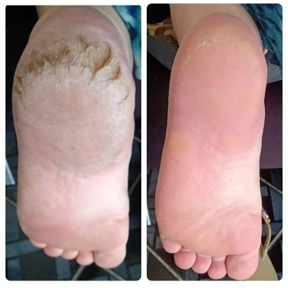 Celulas Mortas: Guia Completo e Onde Comprar | BuscaProdutos