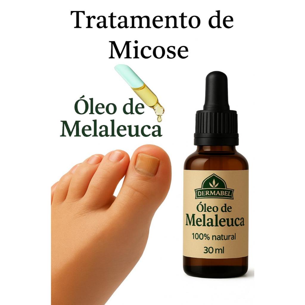 Micoses de Unha Tratamento: Onde Comprar | BuscaProdutos