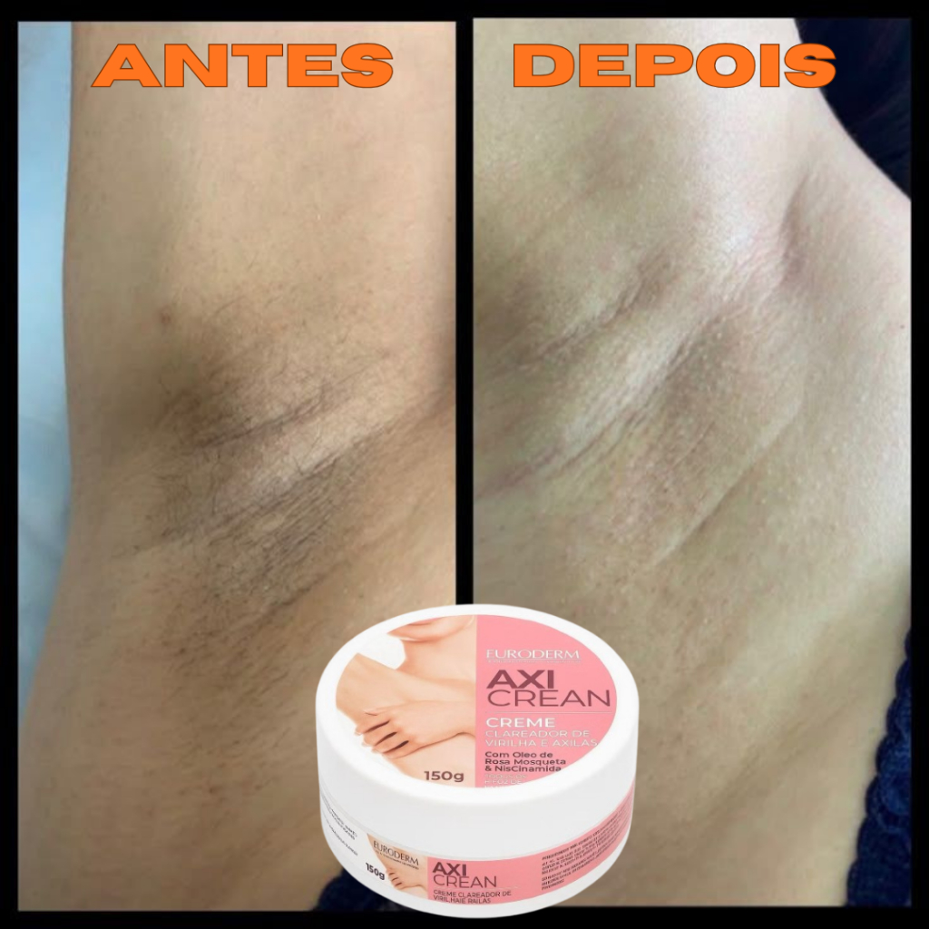 Creme Clareador 150g Clareia Axilas e Virilha Escurecidas Uniformiza o Tom da Pele