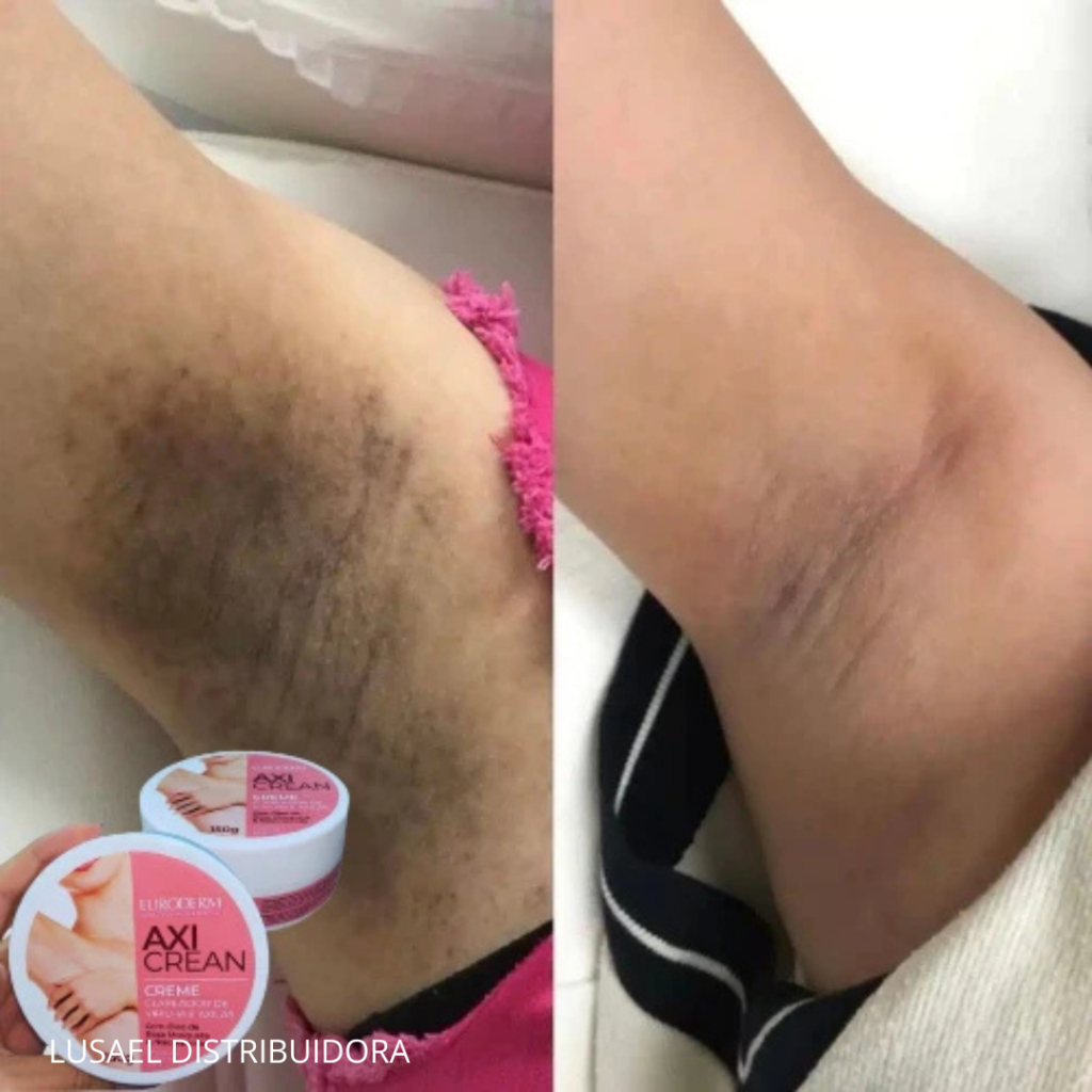 Creme Clareador das Axilas: Onde Comprar | BuscaProdutos