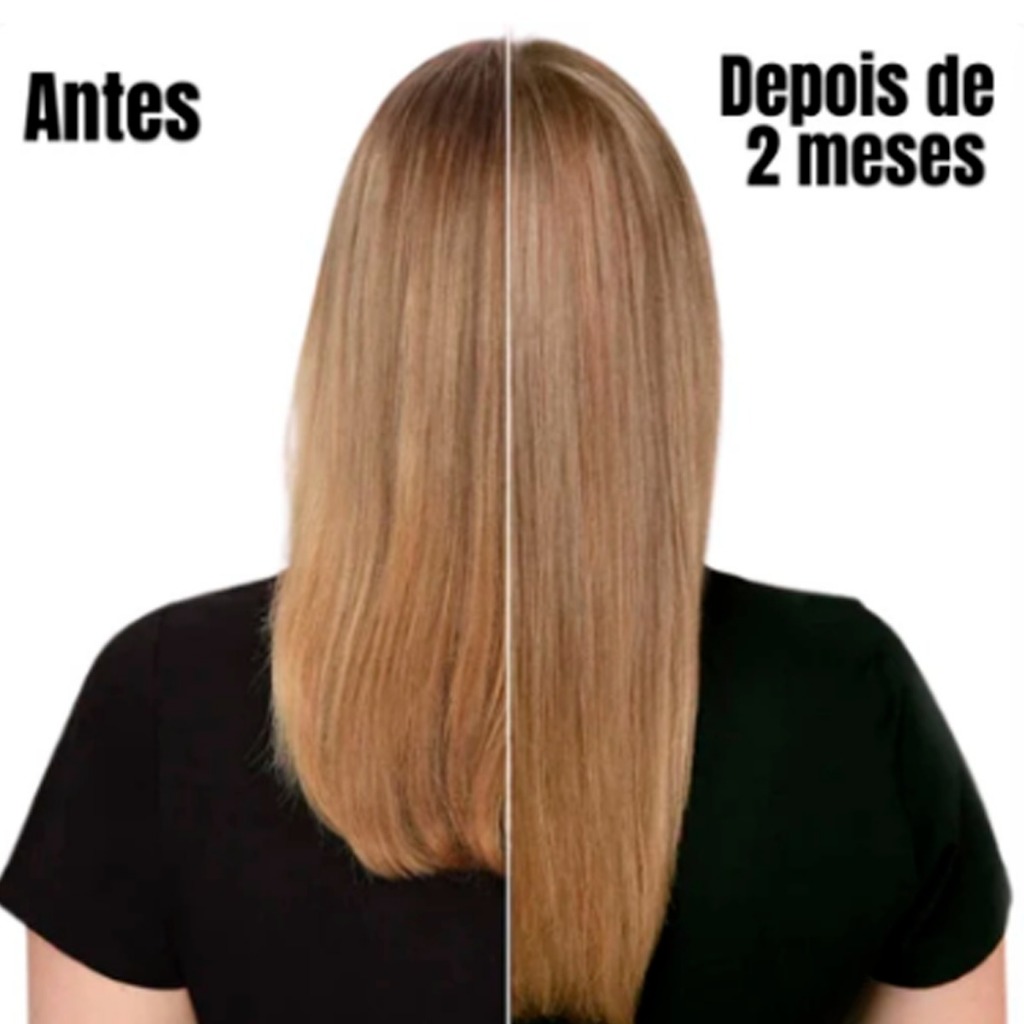 Kit iLike Crescimento Absoluto Shampoo, Condicionador 300ml — imagem 2 de 2