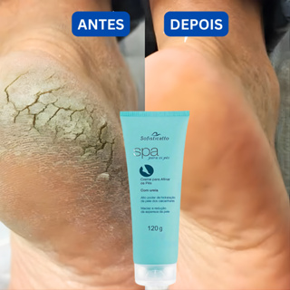 Creme spa dos pés de Pedreiro  para pe rachado pele ressecada Cotovelo Grosso Joelho Grosso Ureia em Oferta na Shopee